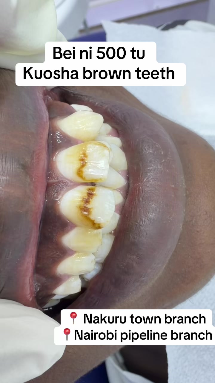 @Tiba dental care