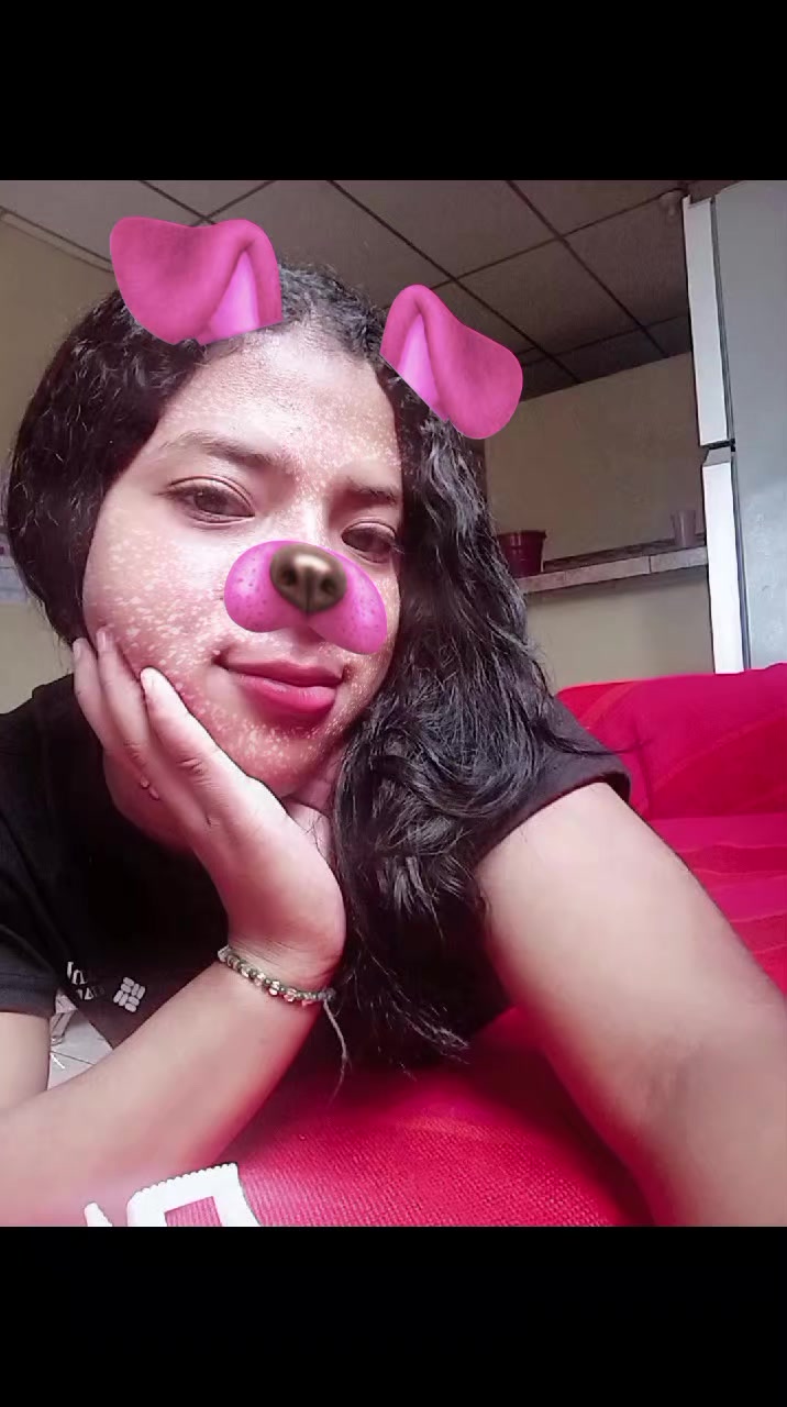 @chica 😍❤️🩹
