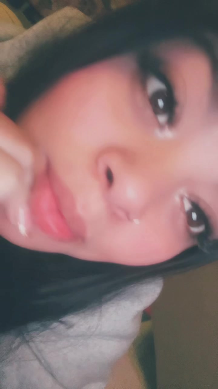 @777
