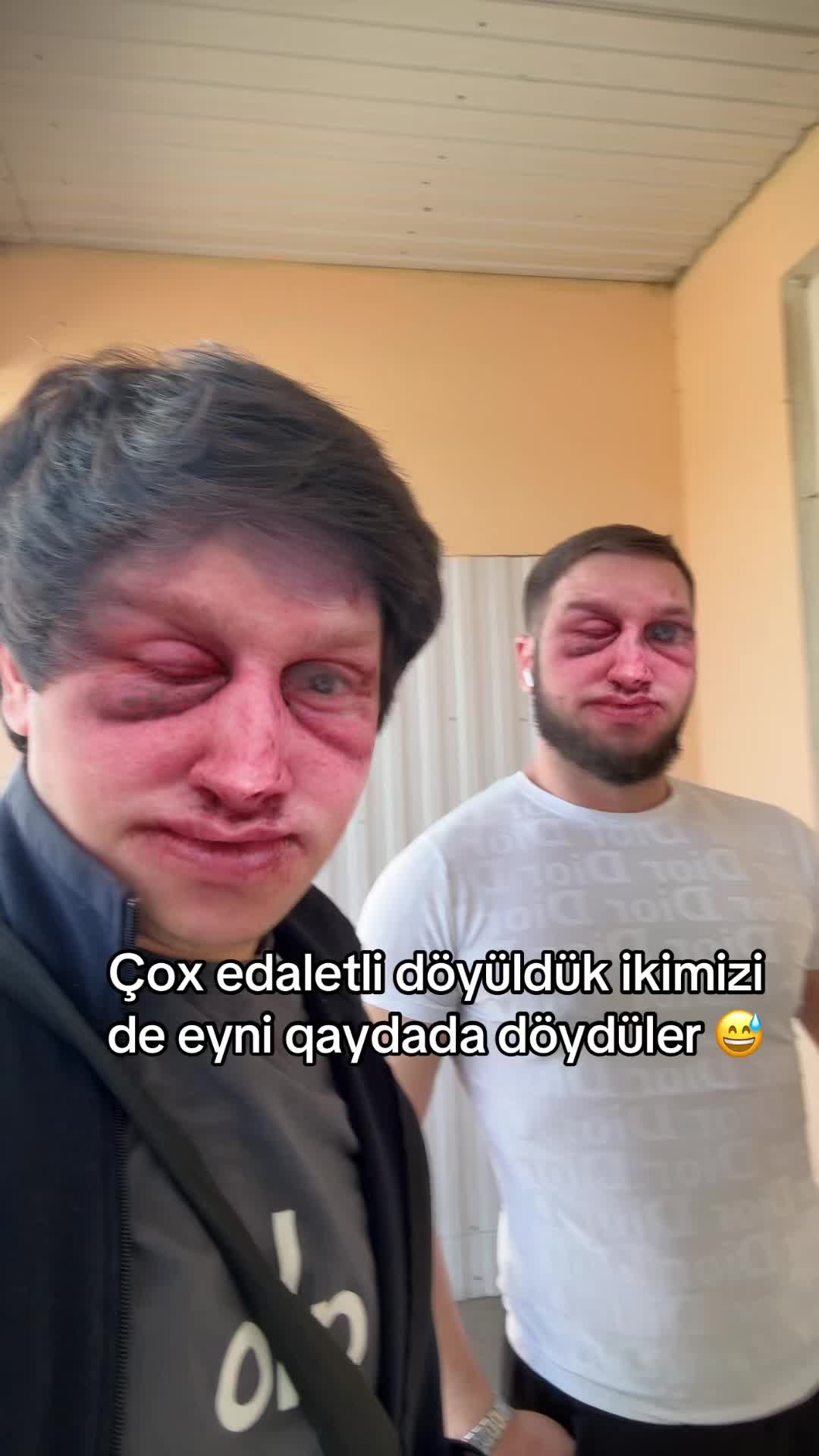 @Талыш044🇦🇿🇷🇺