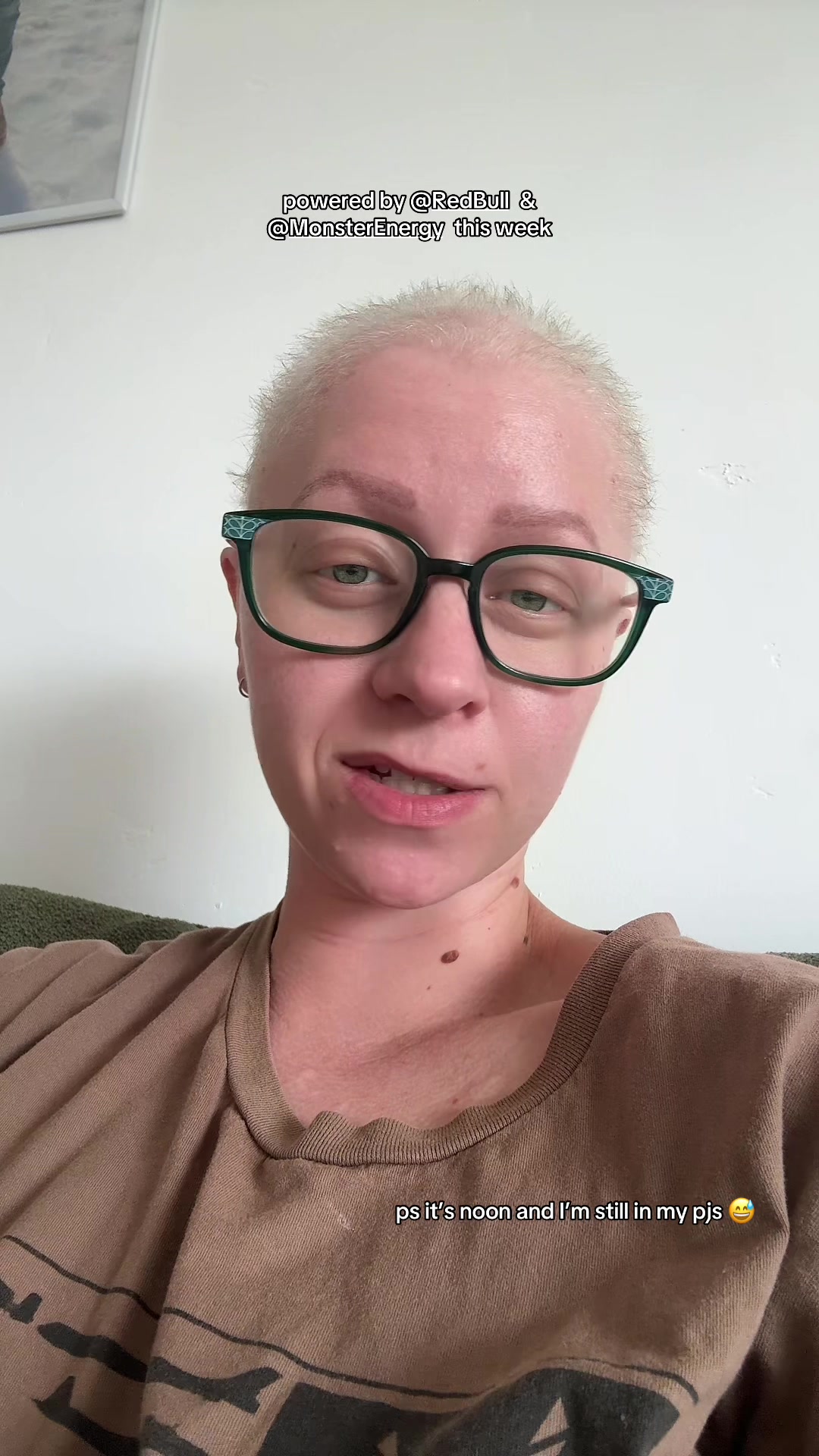 @KK’s lupus journey!