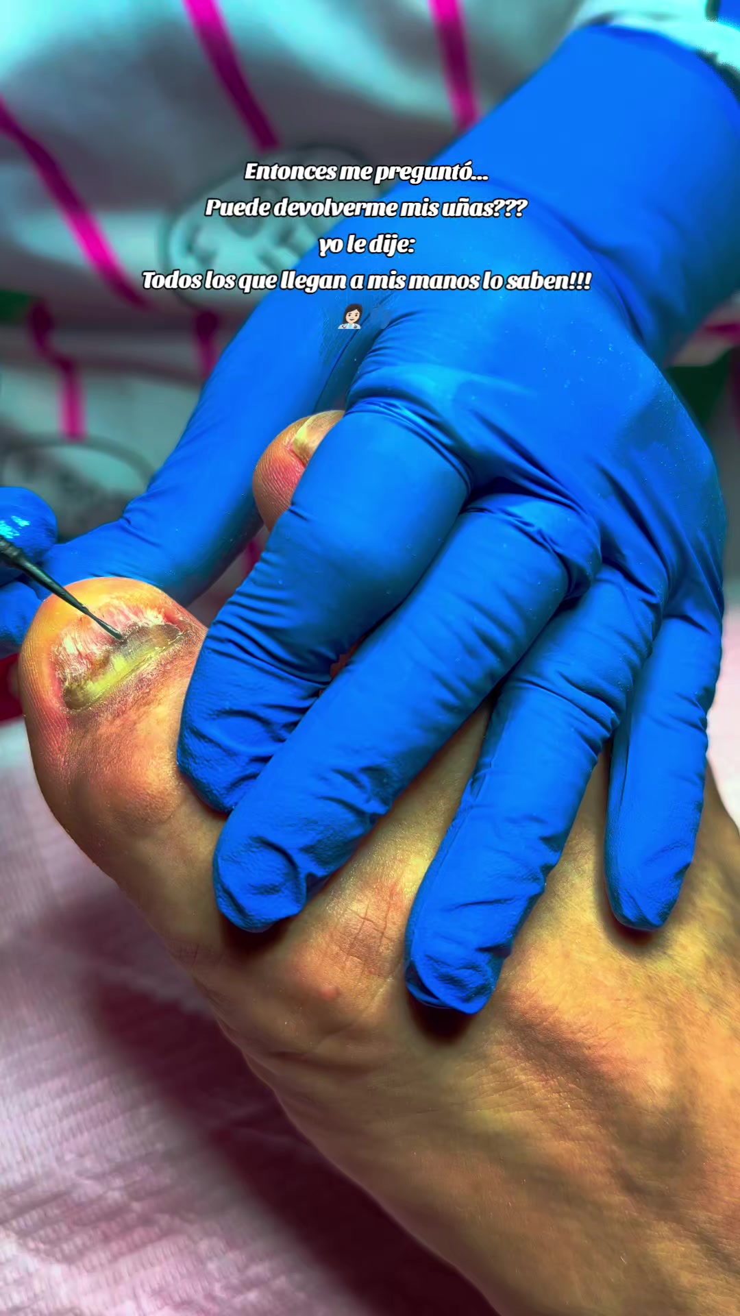 @Podomédical🇵🇪