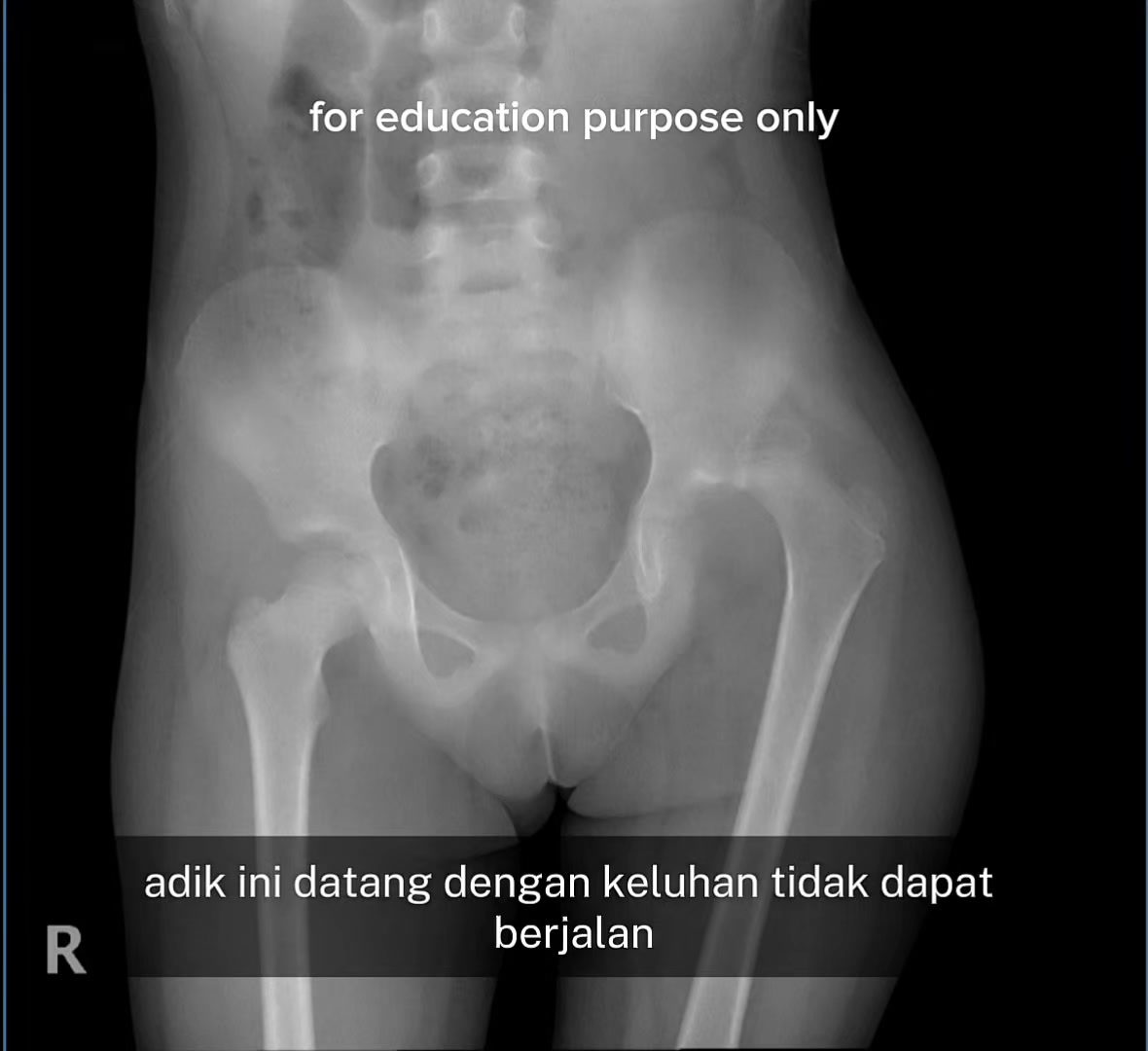 @Sobat Radiology