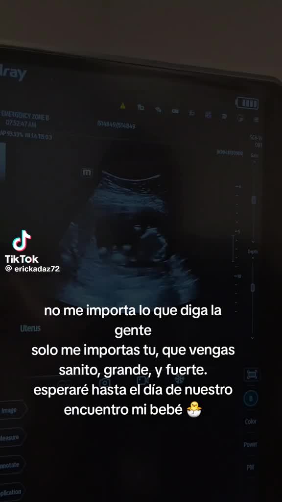 @Ericka Diaz
