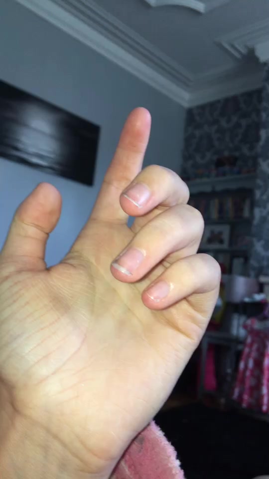 @Secret xo