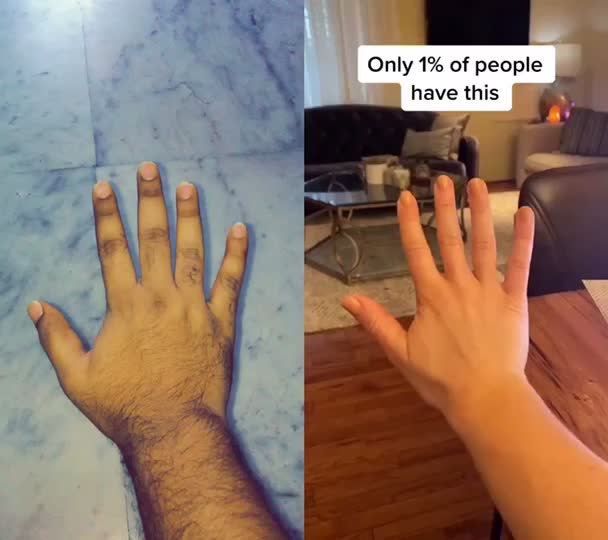 @Abhinav Raynor