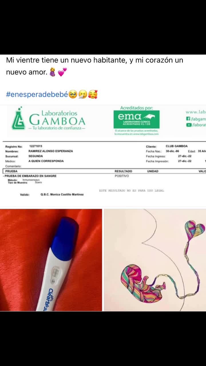 @Esperanza Alonso