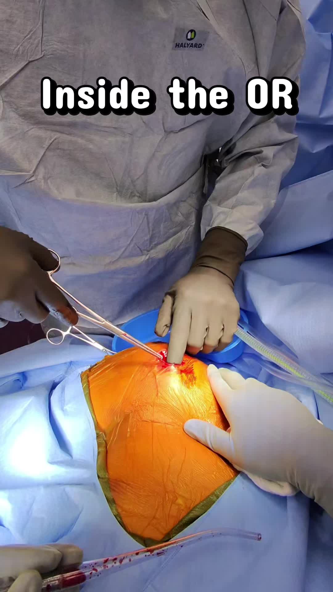 @Ortho POV