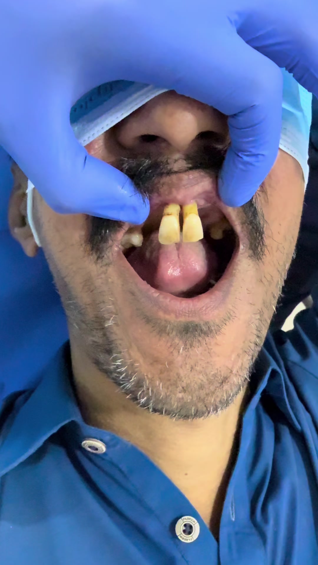 @Dr- syed numan official✅✅