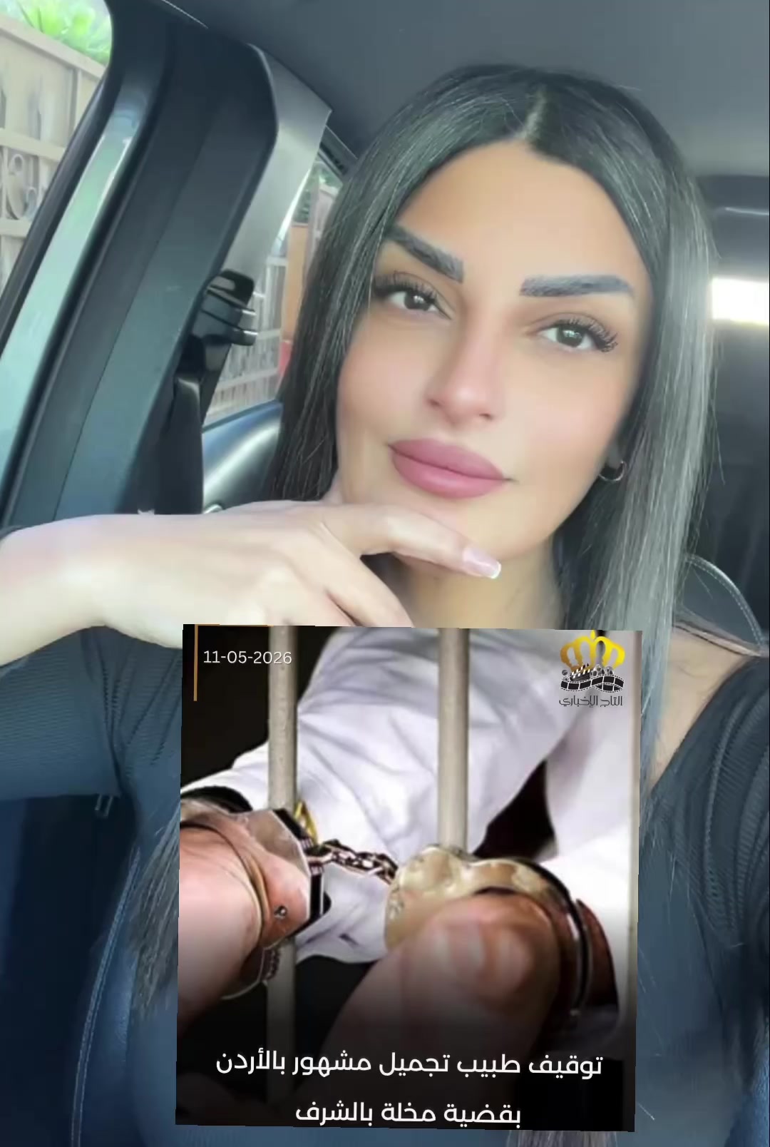 @ايه ابوعتيله