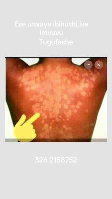 @Muganga marynaturalherbs