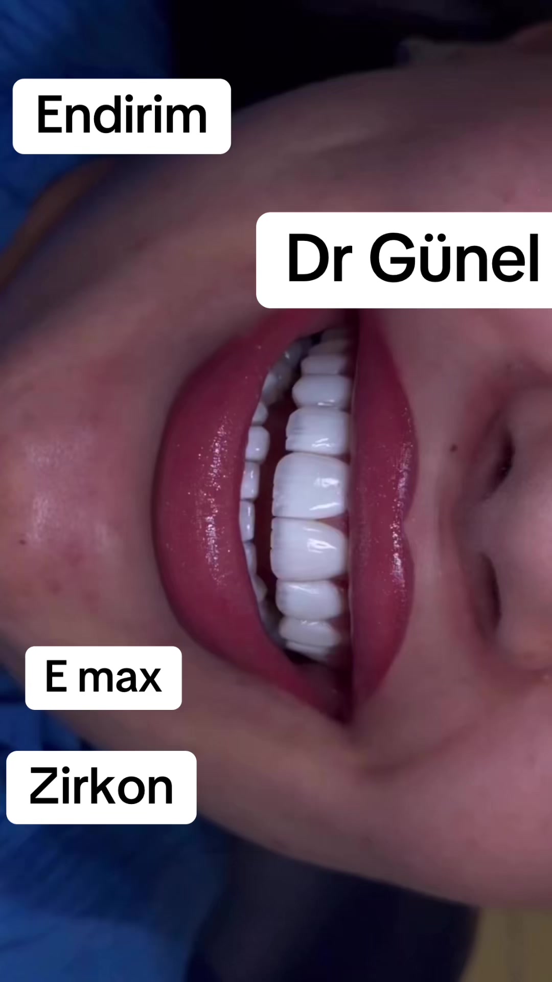 @Dentist_Günel