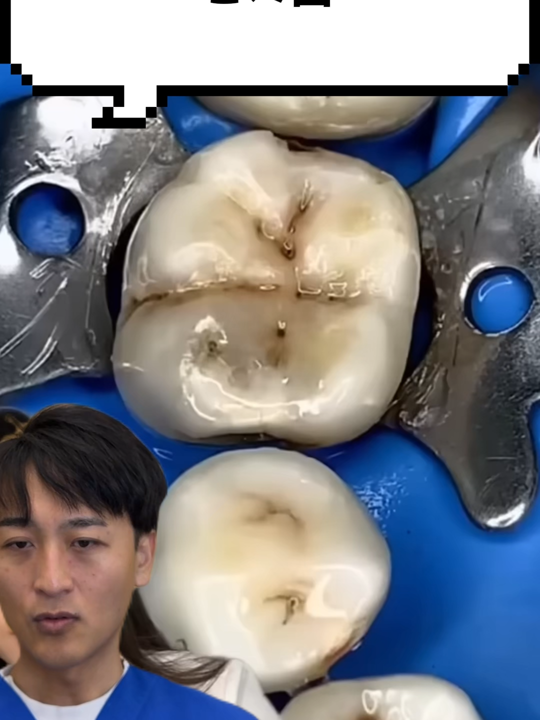 @金歯先生☆歯医者
