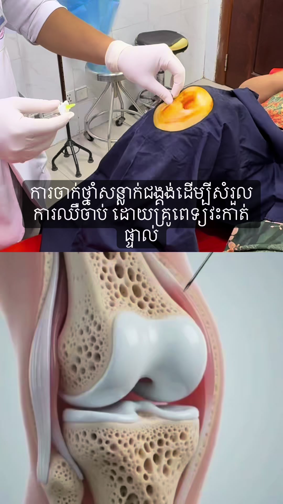 @Dr.Solidet-វះកាត់ឆ្អឹង