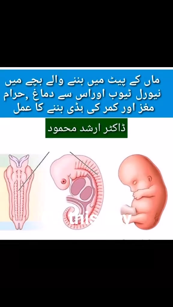 @Dr Arshad Child Neurologist