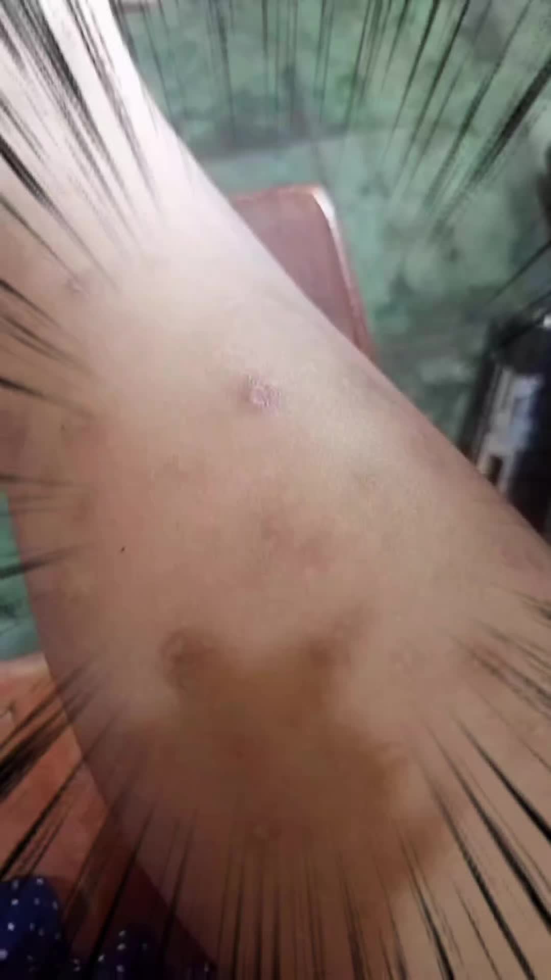 @Cirancana