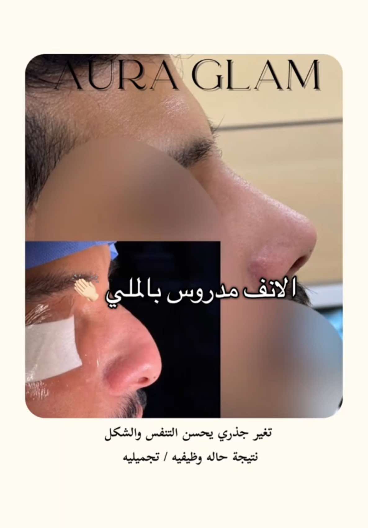 @AURA GLAM | أورا قلام