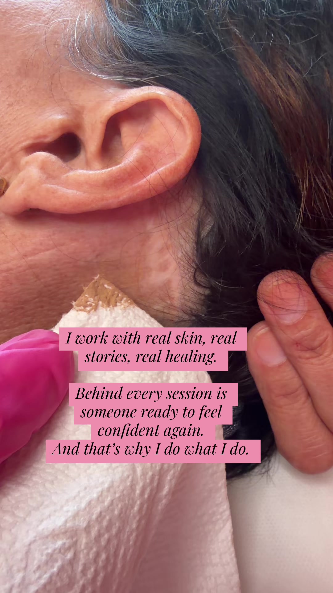 @Invisibleskinhelp