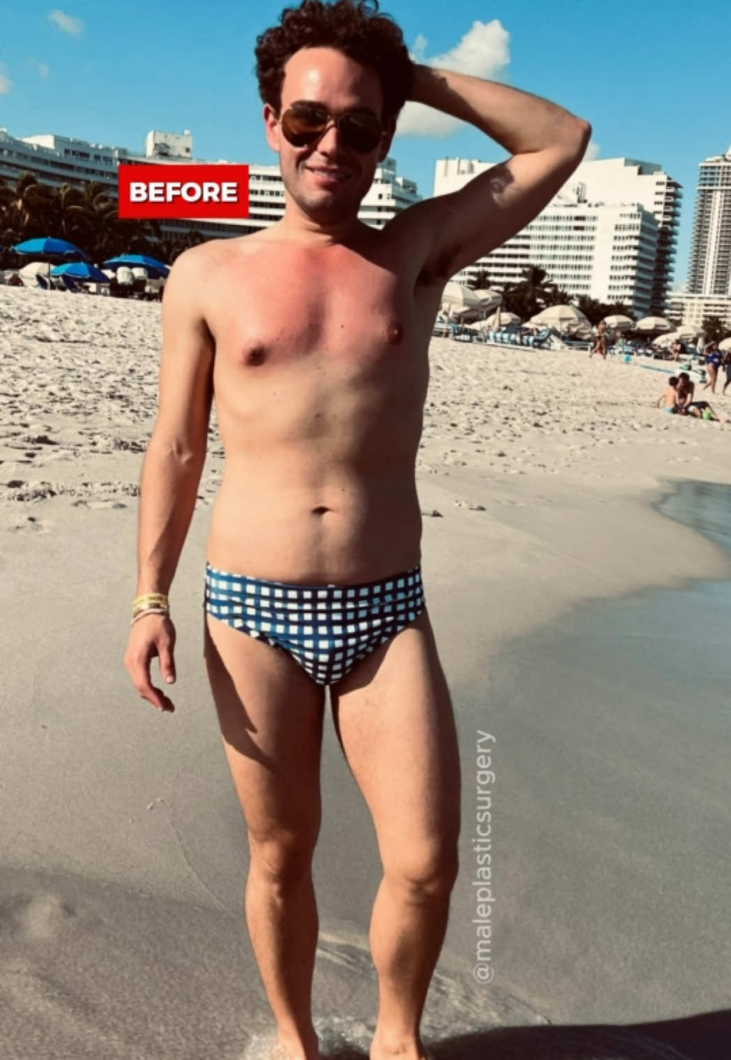 @mensplasticsurgery