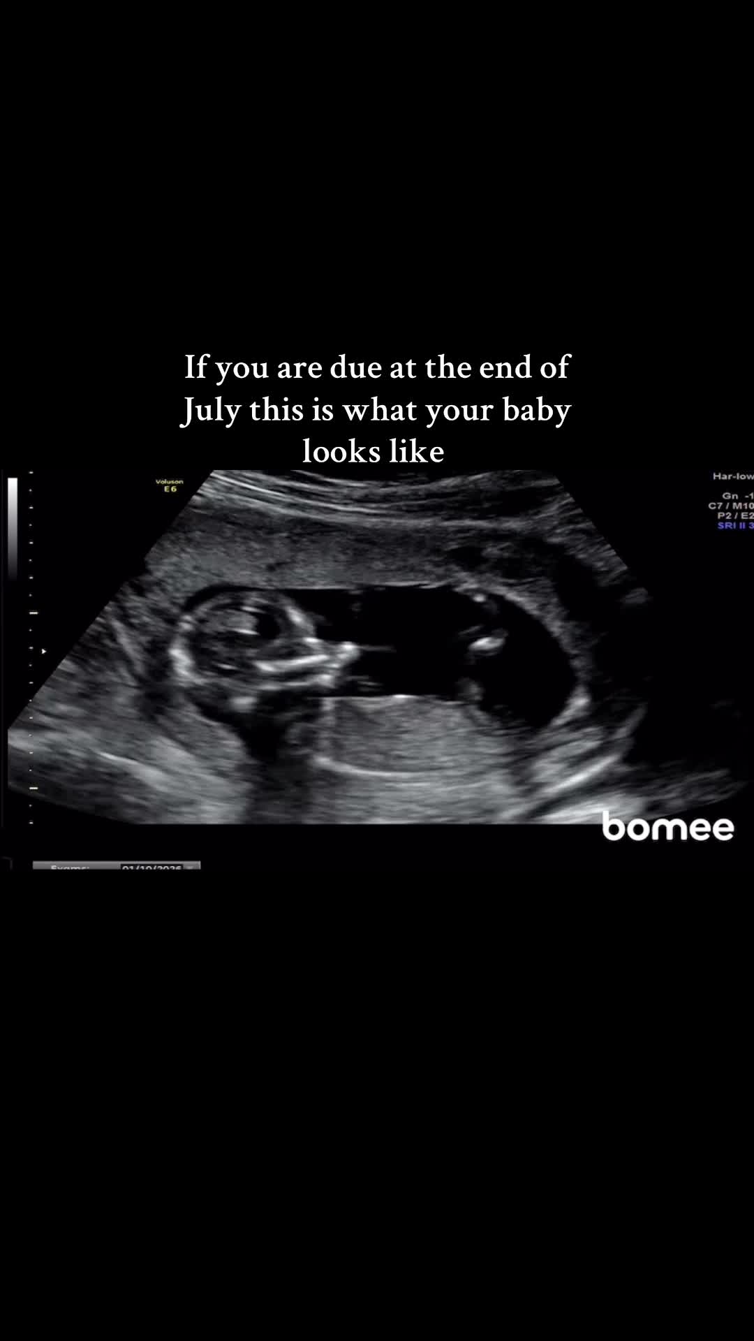 @j | ivf mama ❤️