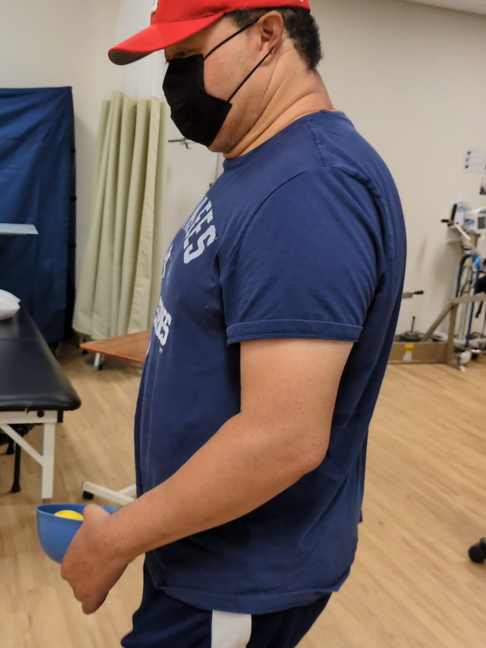 @Stroke SURVIVOR Sal
