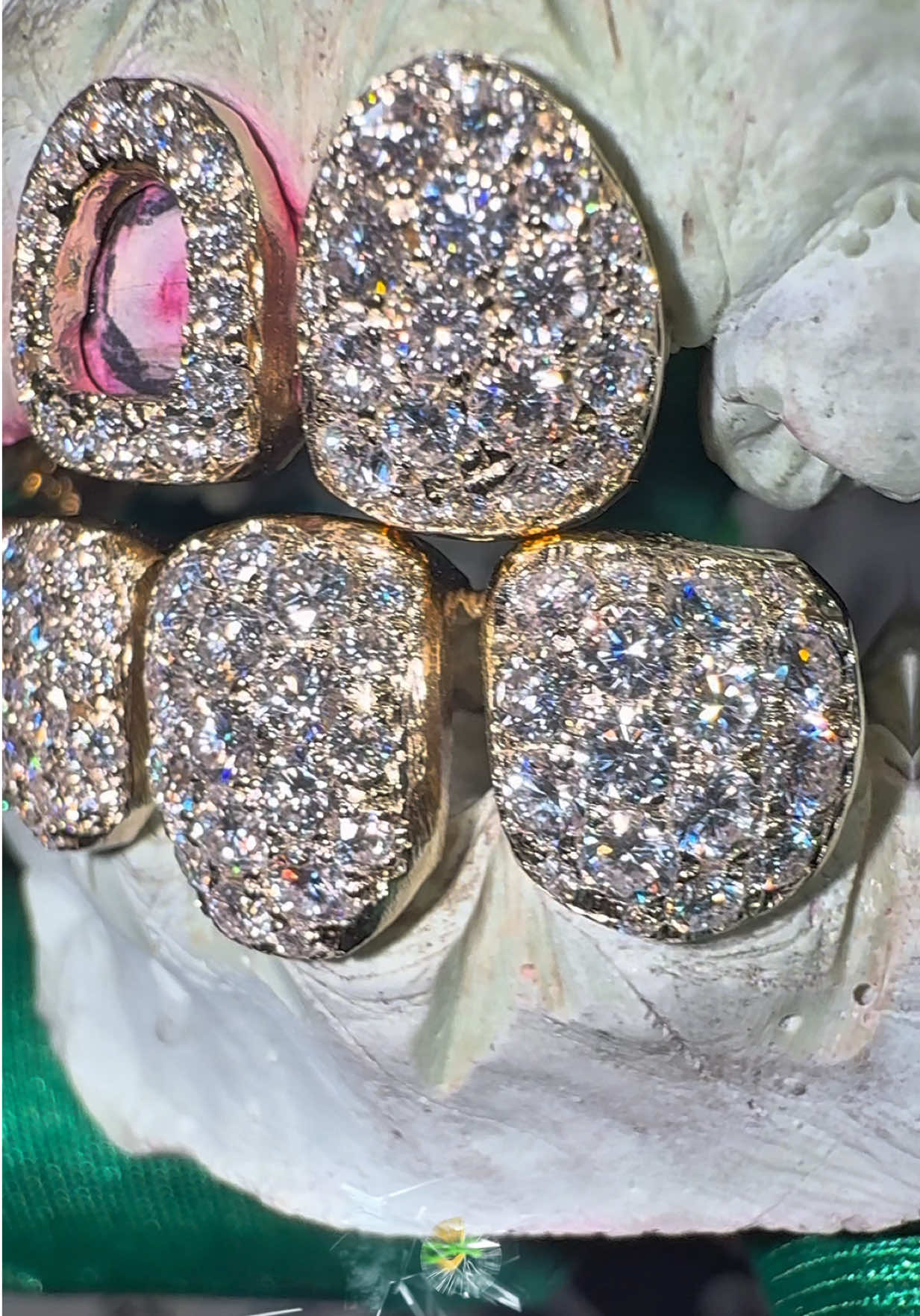 @GoldMoneyGrillz