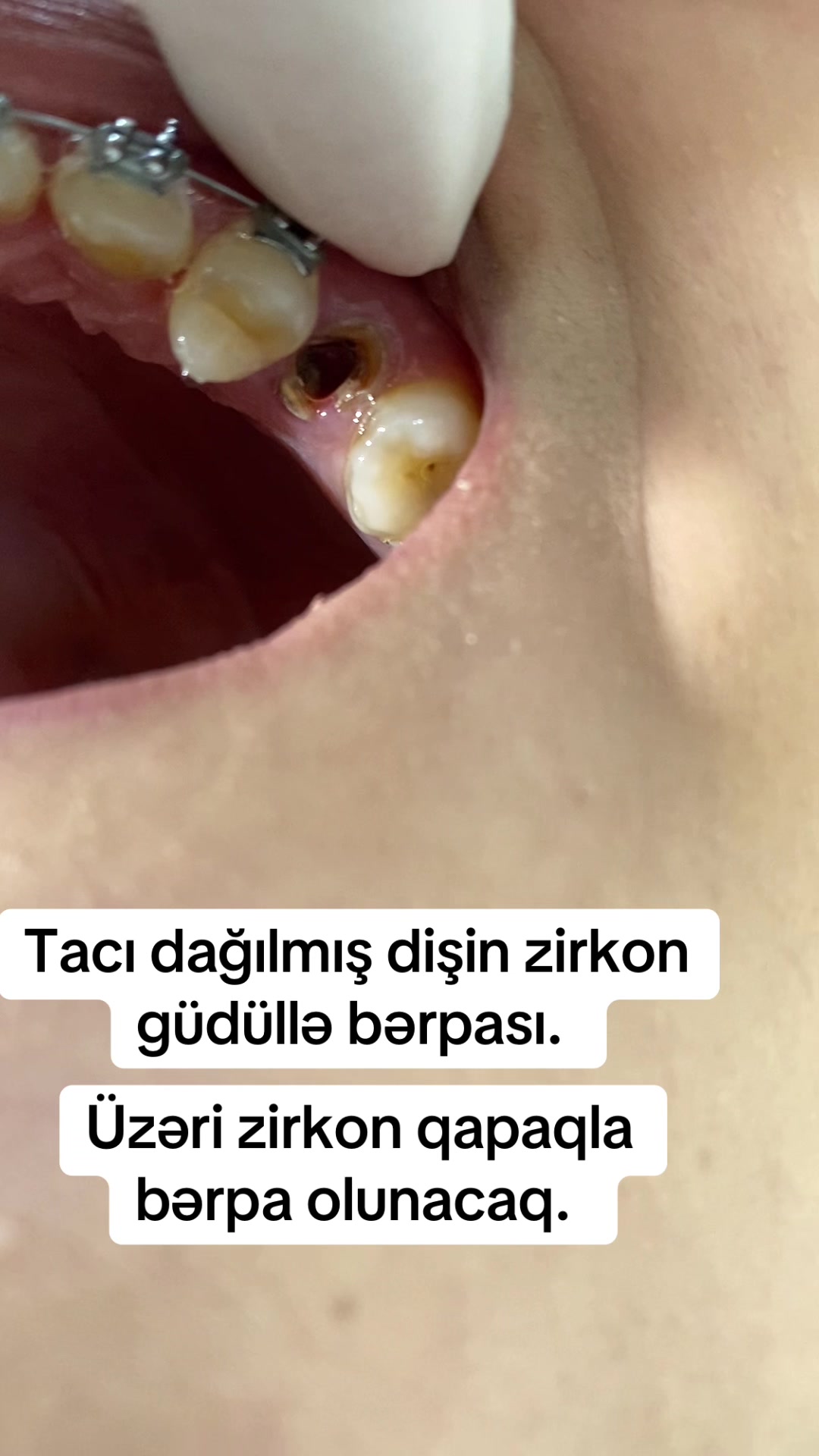@dr_həmzət__