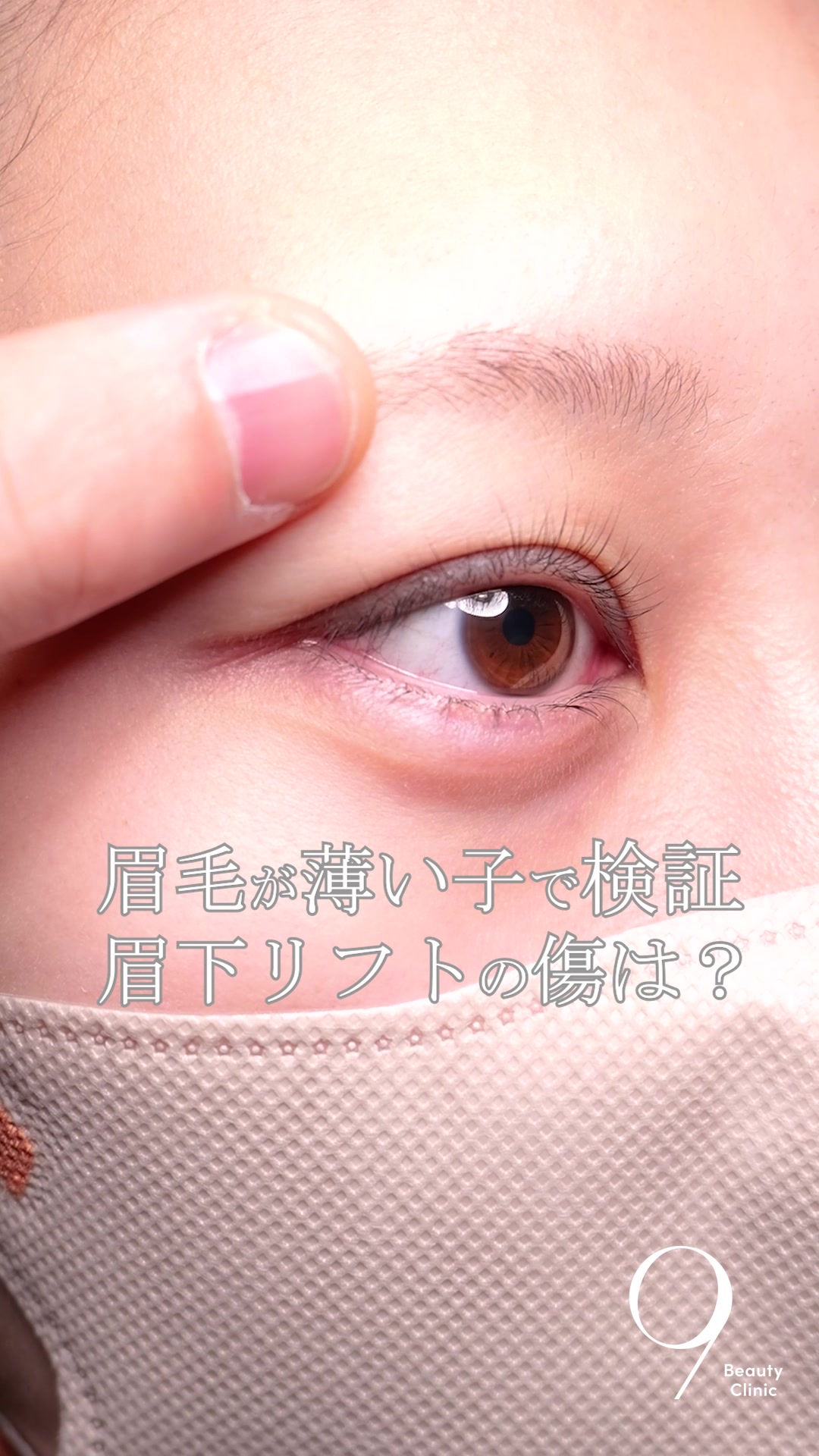 @りく先生　目元切開/クマ治療