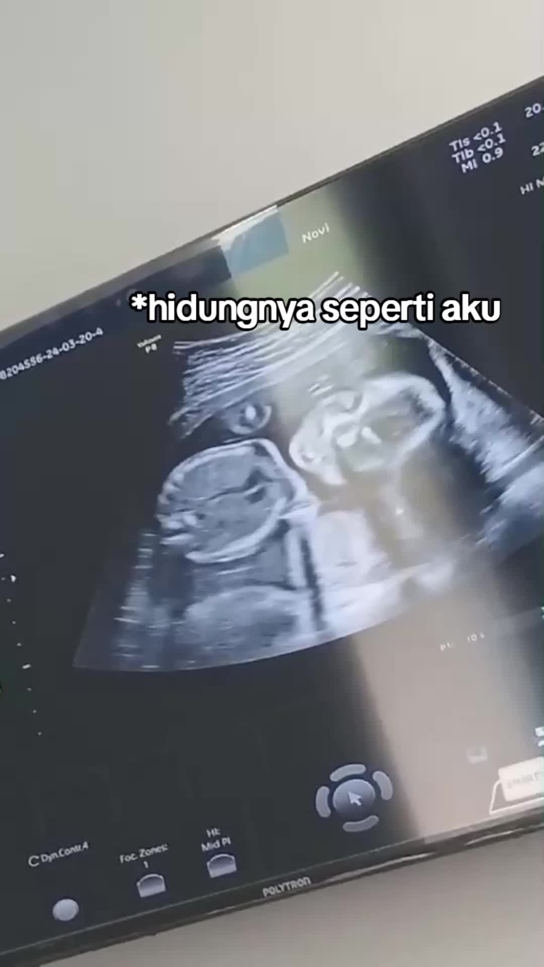 @cantiktwentyfiveyears