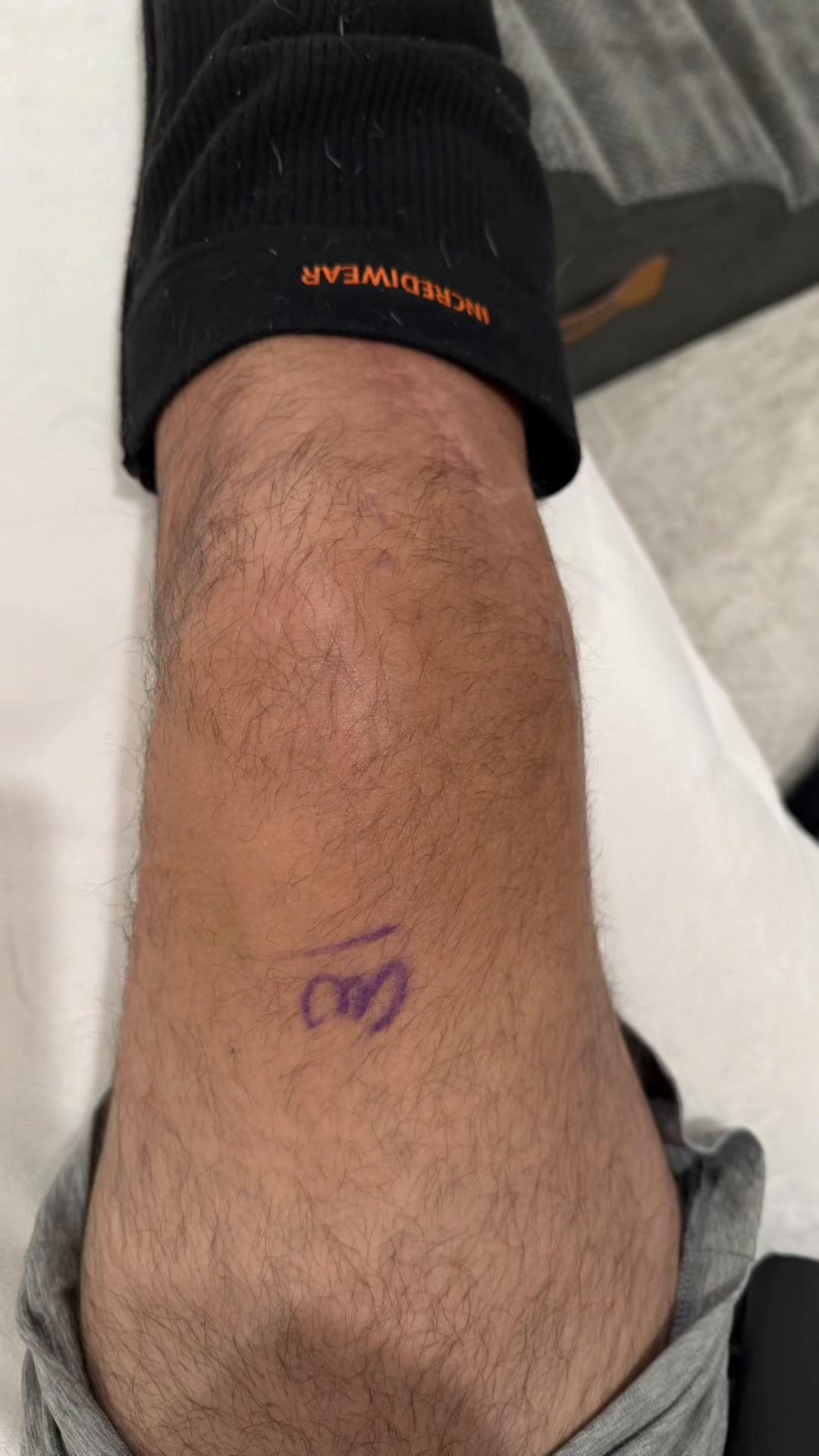@Dan | Knee Recovery