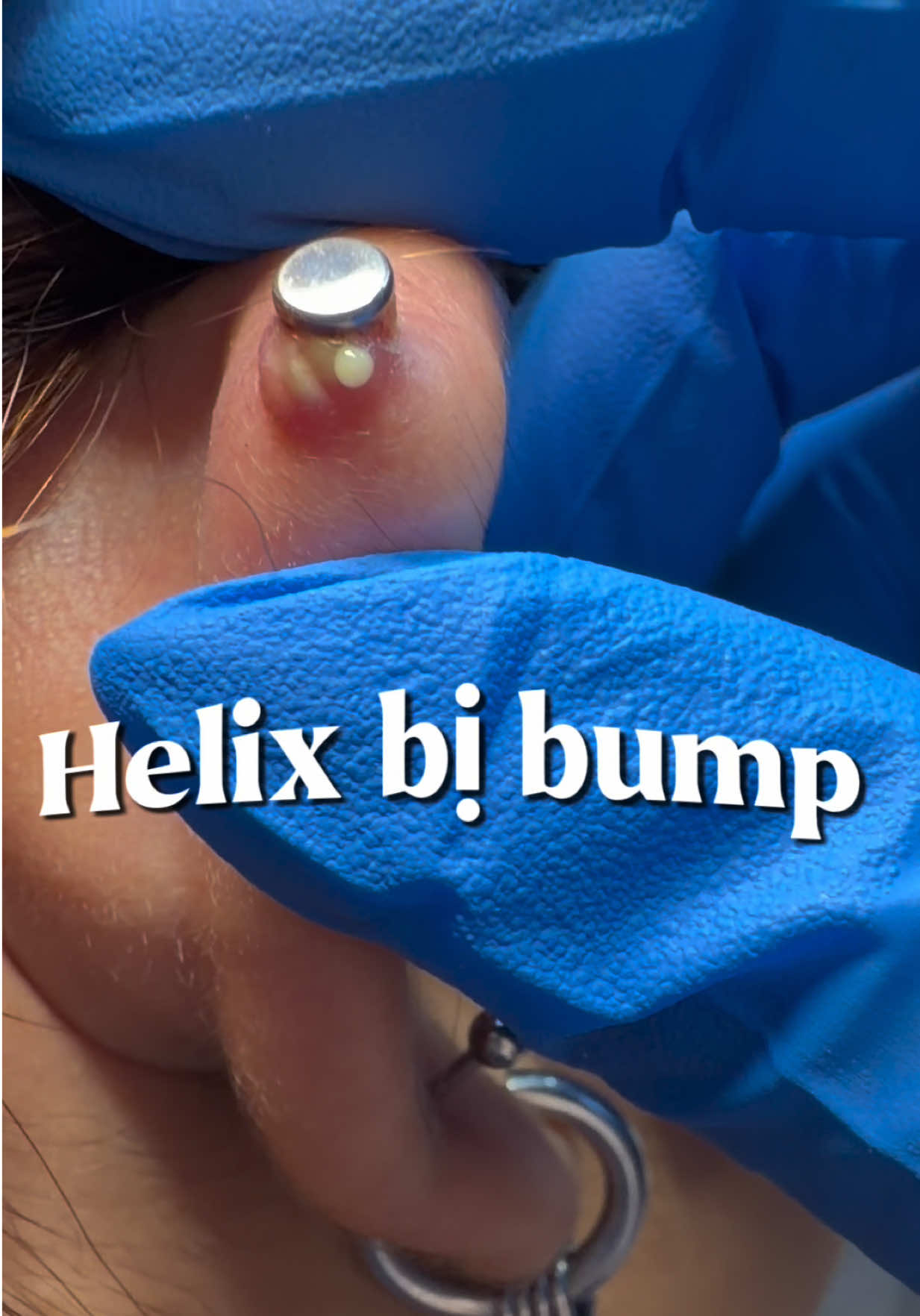@Xỏ khuyên-ToothGems Vũng Tàu