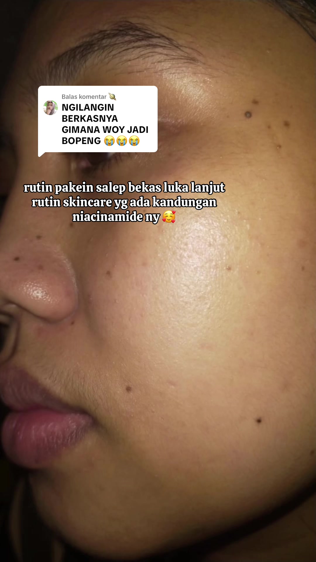 @Penghilangtahilalat.kaq.ay