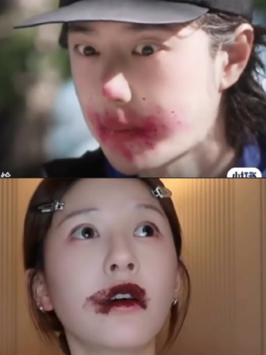@Bias