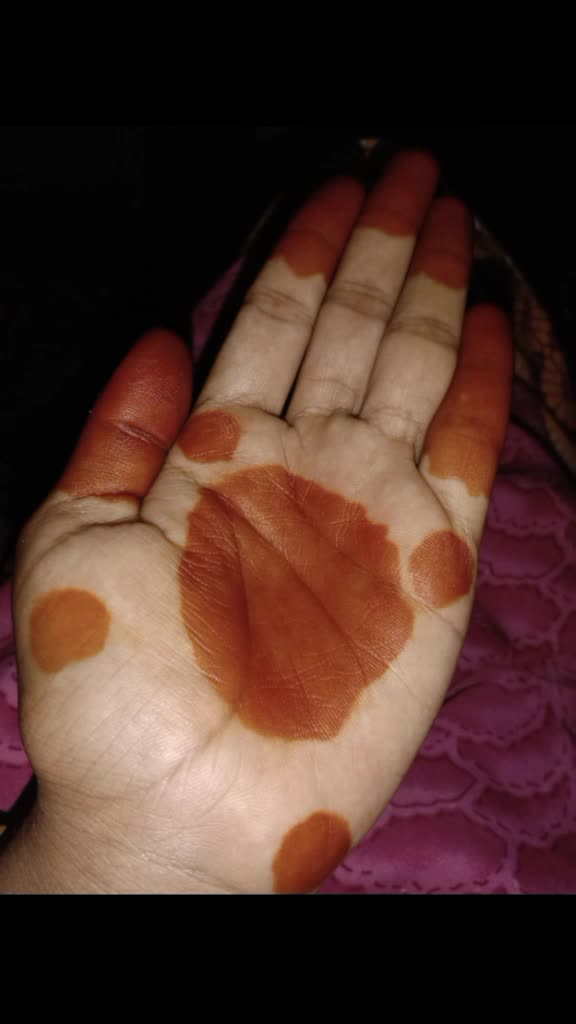 @Balakrishna Muthyala