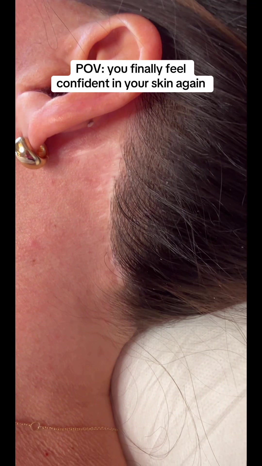 @Invisibleskinhelp