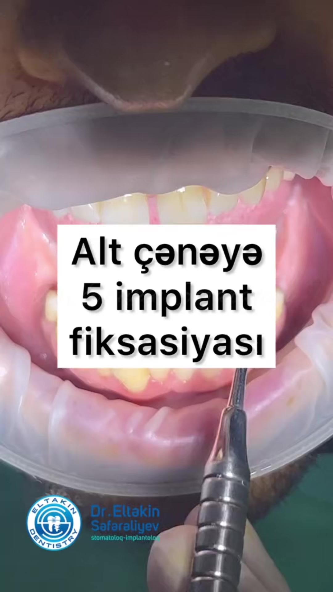 @eltakindentistry