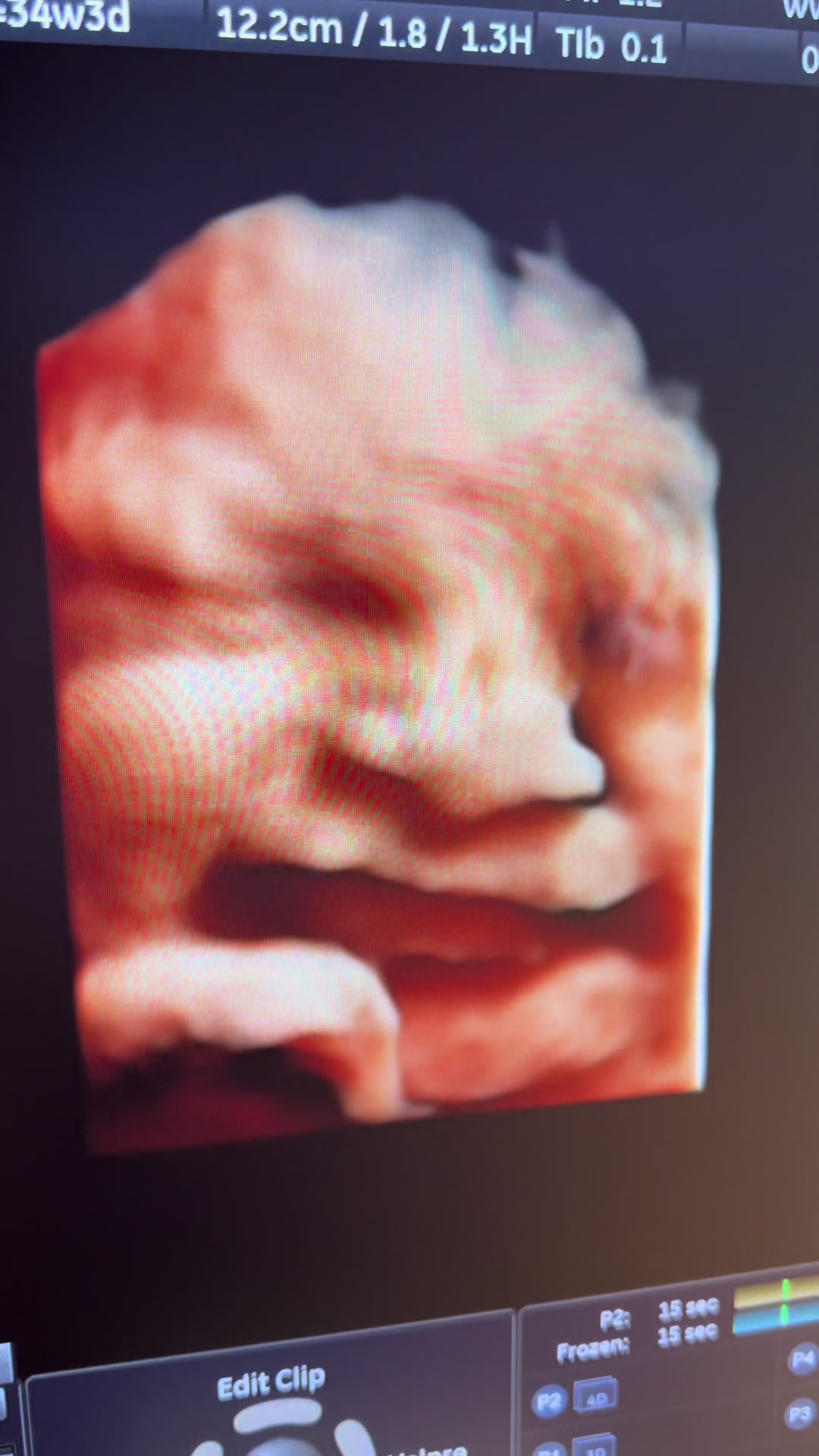 @PregnantSee Inc.