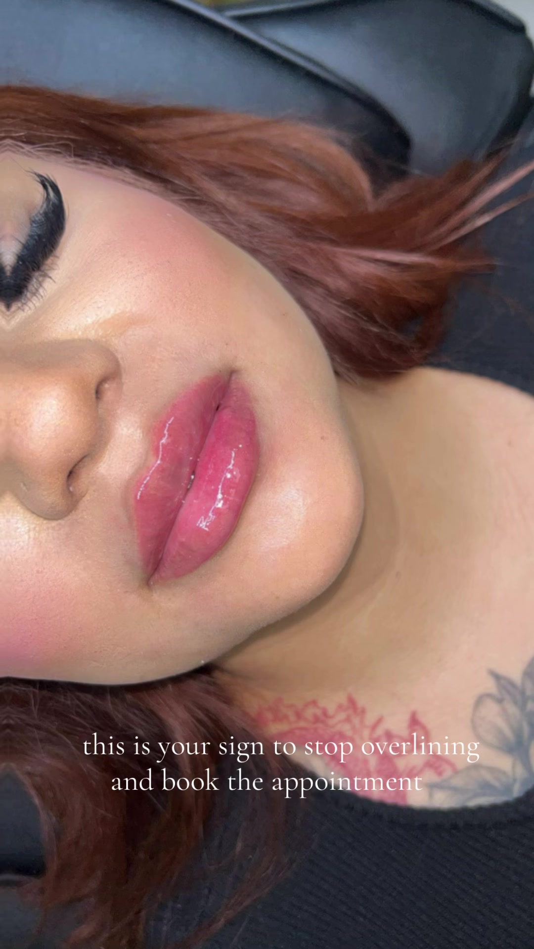 @injectormami