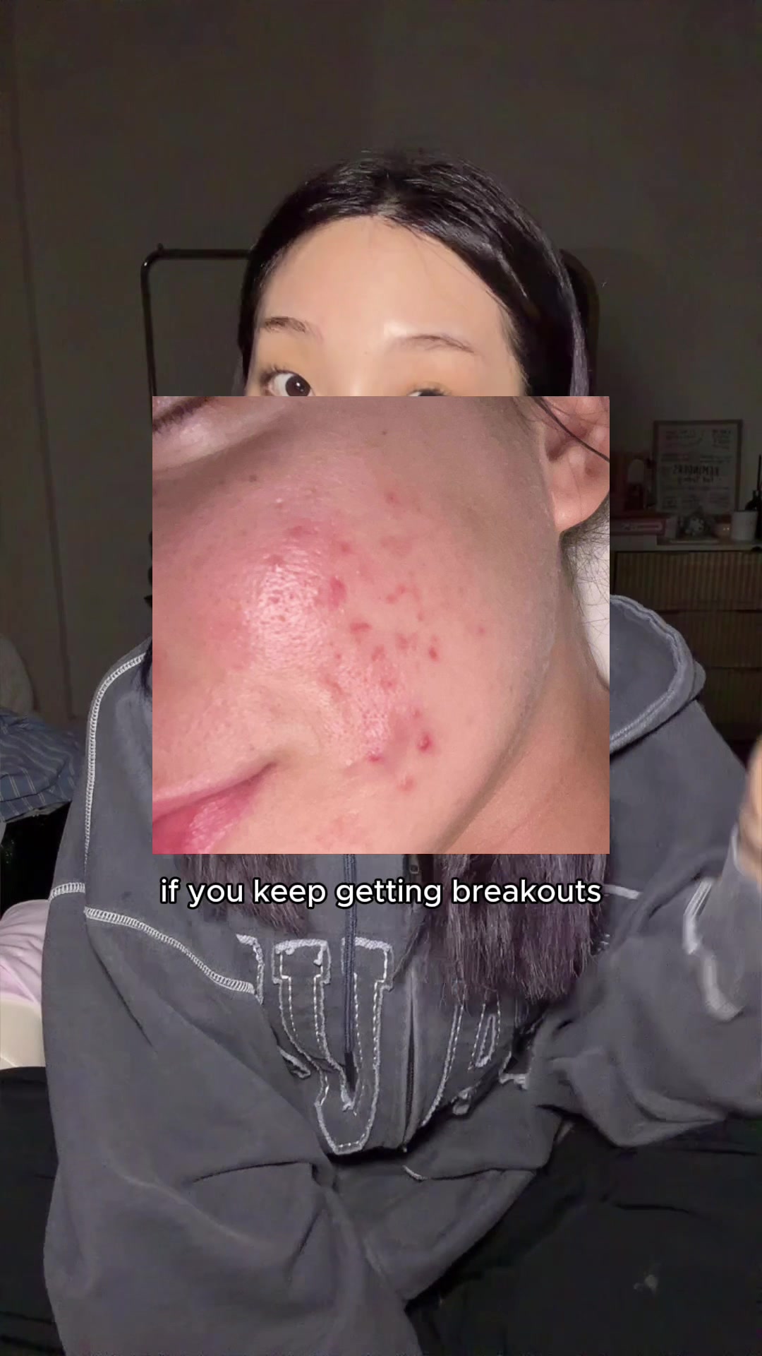@lily