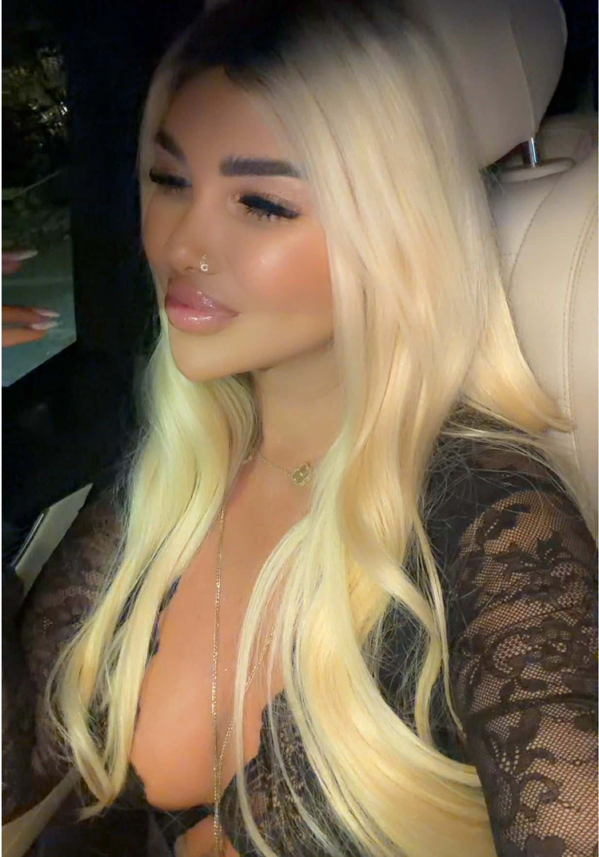 @Arbesa Mehmedaliu