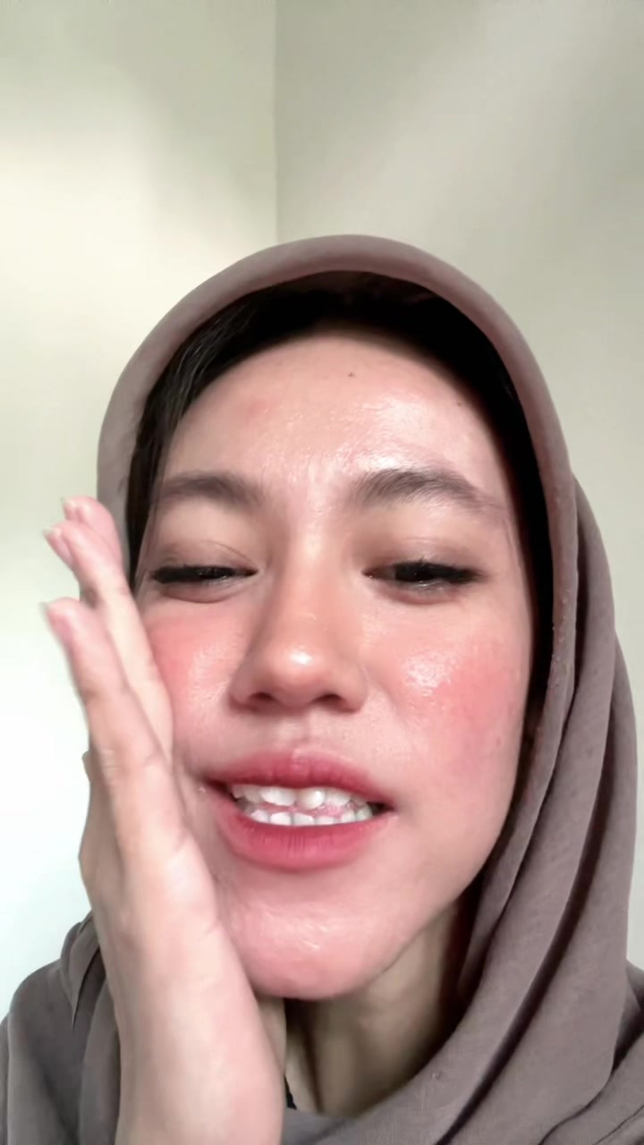 @Ichaa | acnefighter