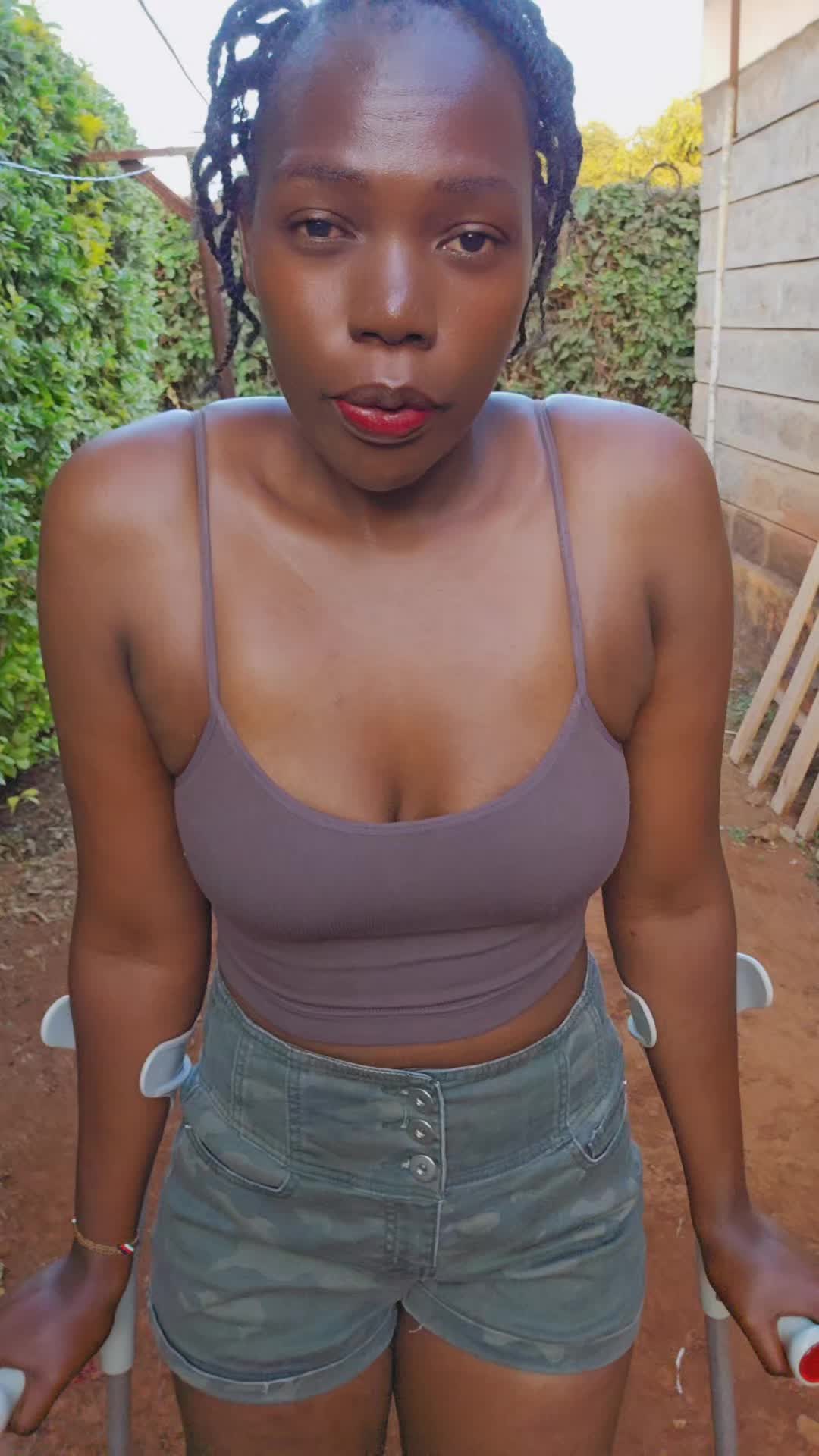 @💎Nattie Amputee🇰🇪♊️