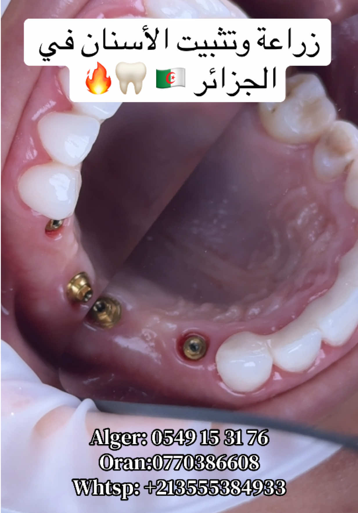 @Dr.ladjali