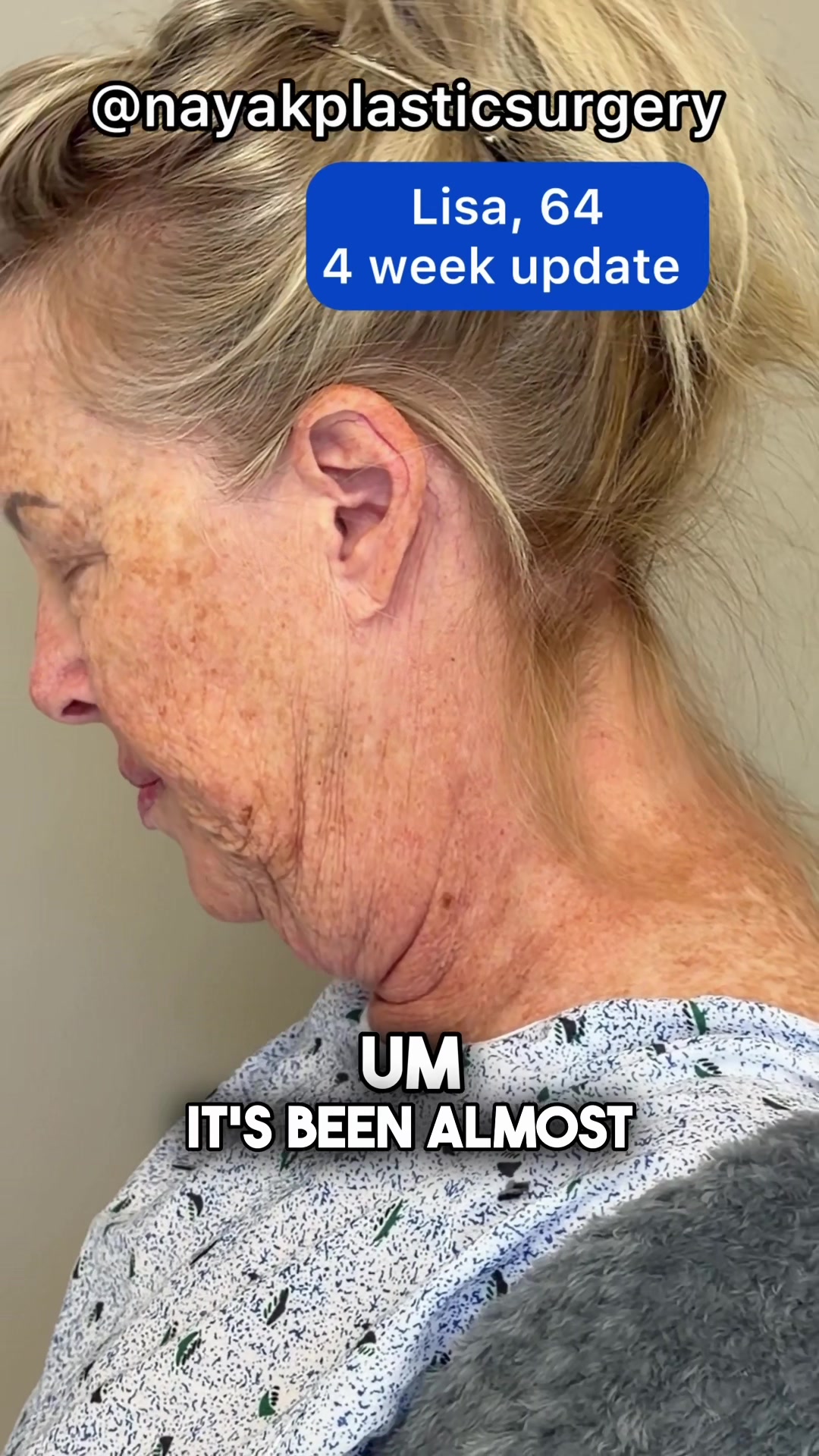 @NayakPlasticSurgery