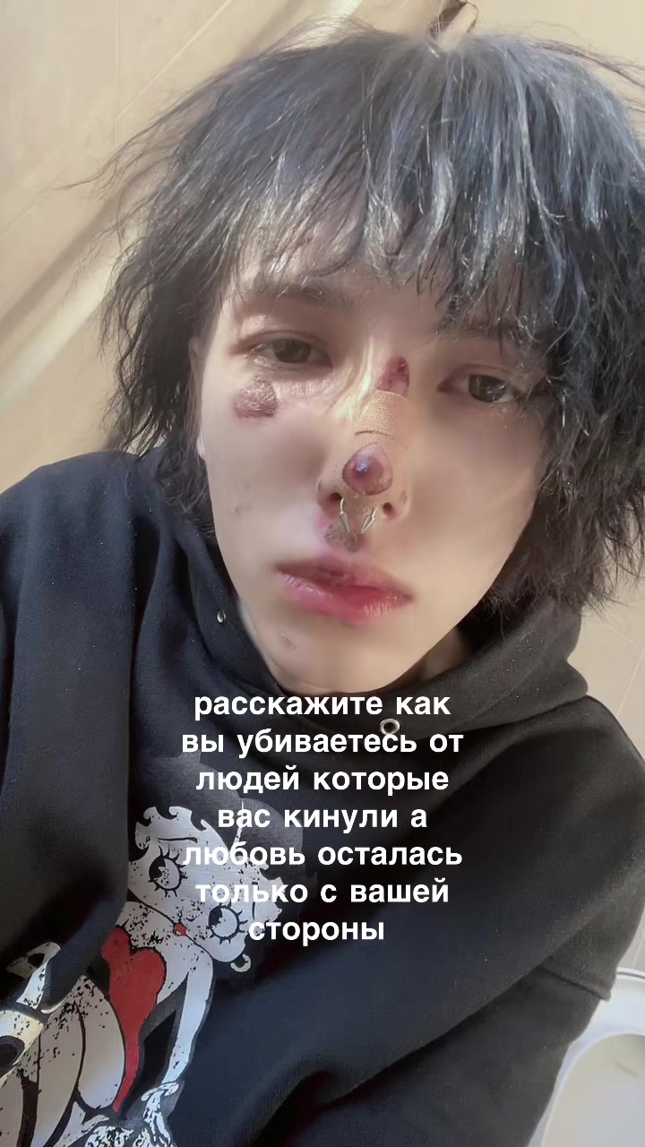 @archetype
