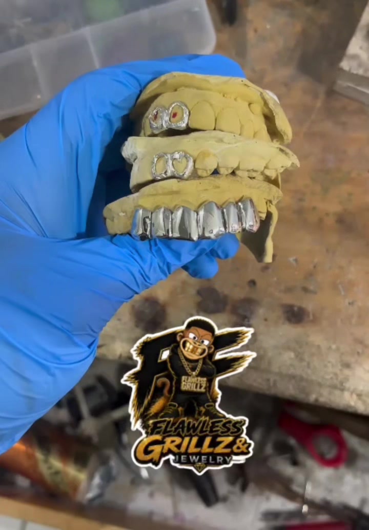 @Flawless Grillz