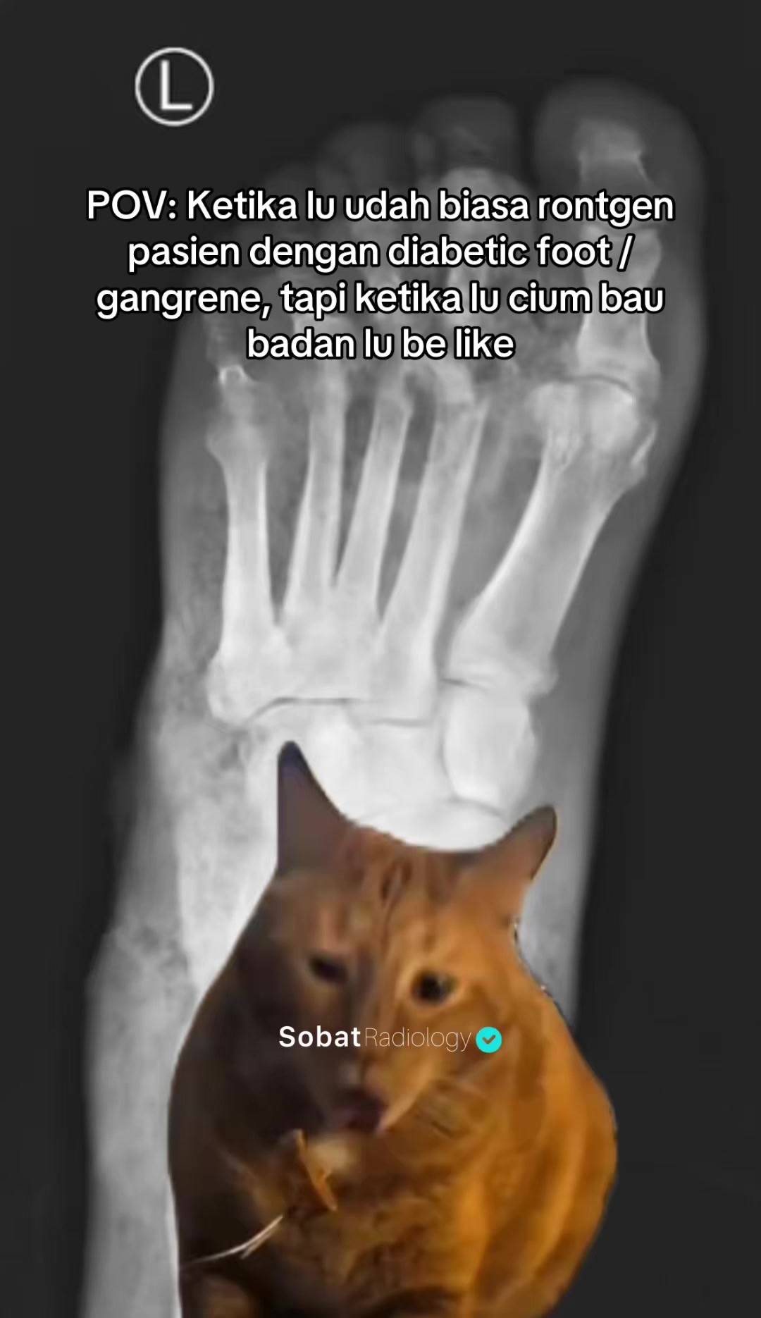 @Sobat Radiology