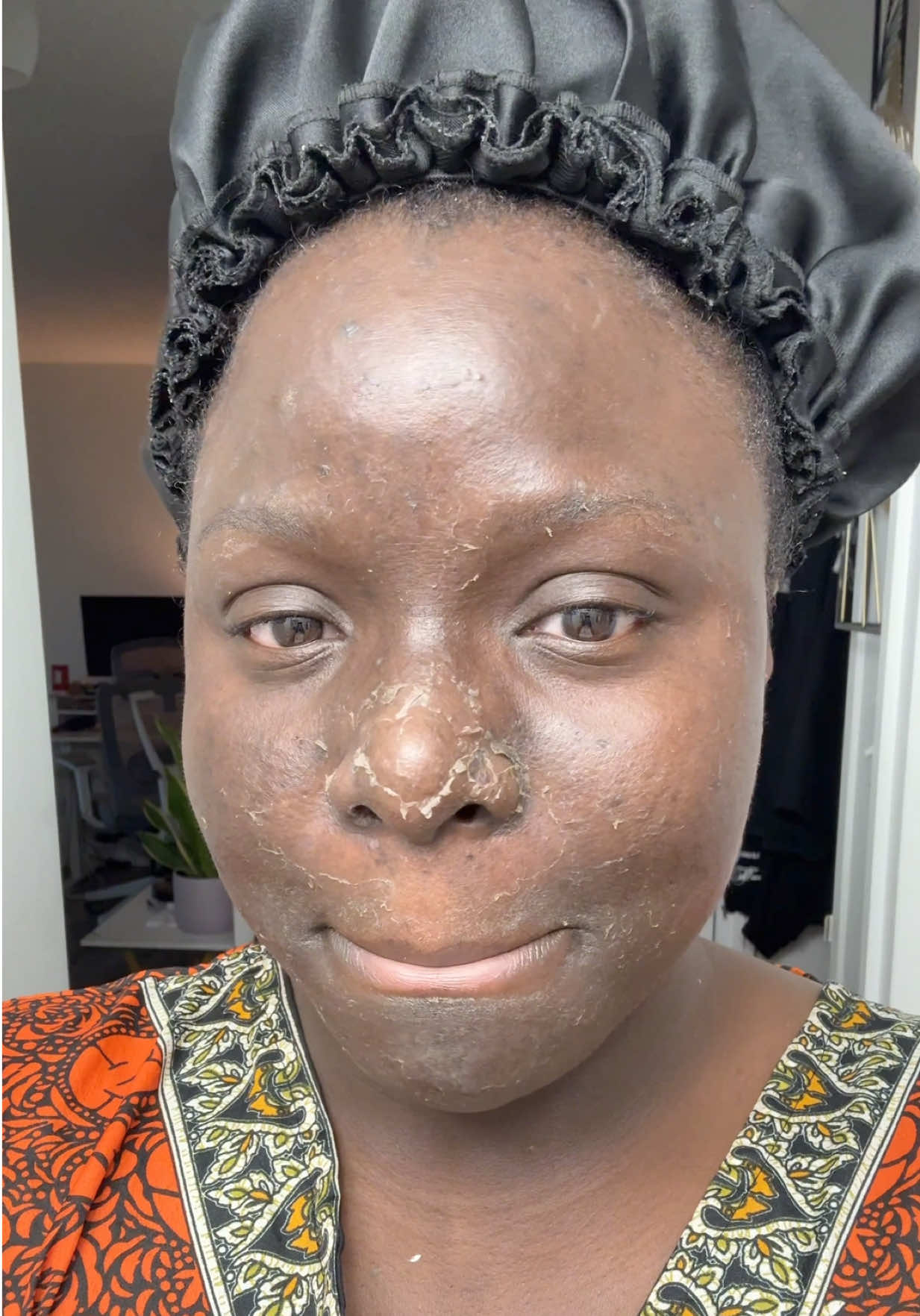 @ADENIKÉ