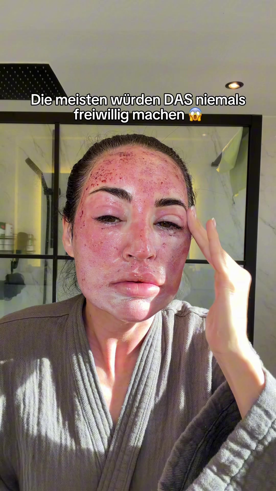 @Melissa | BEAUTYEXPERT