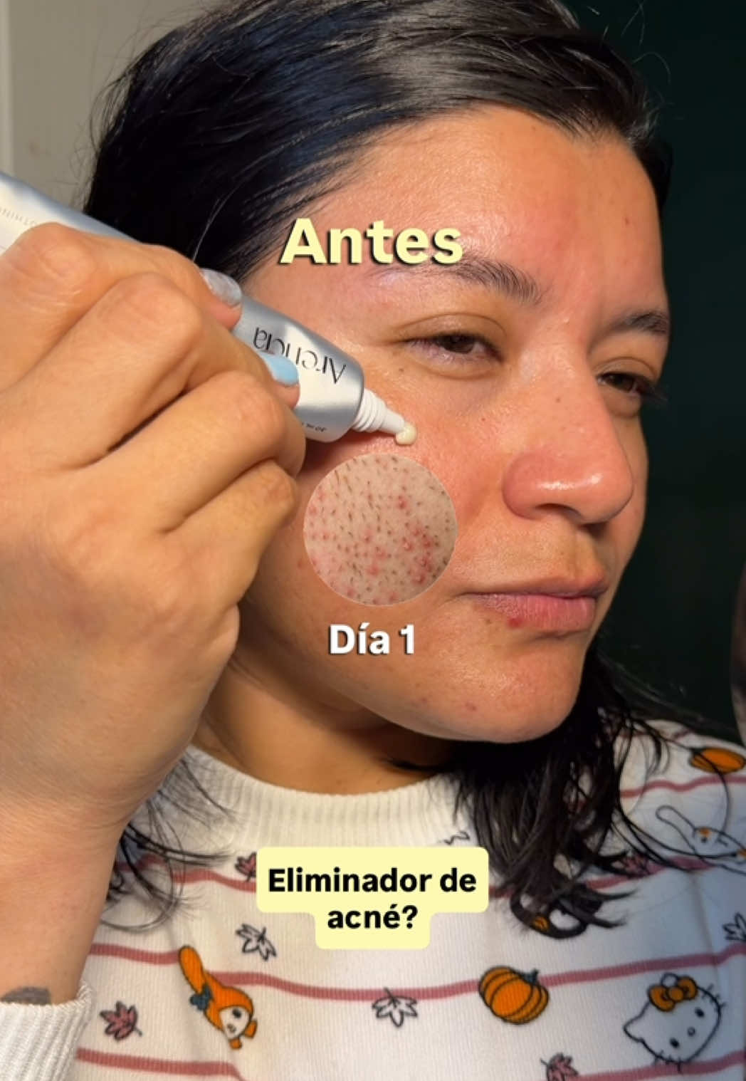 @Melo Autumn